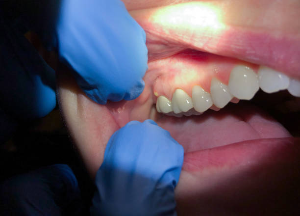 Best Emergency Gum Pain Relief  in Loomis, CA