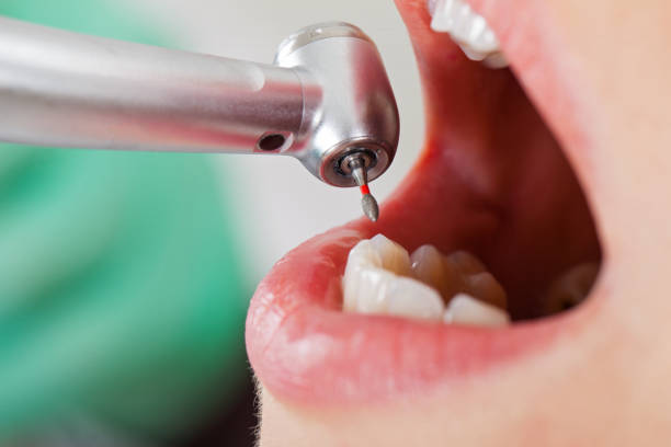 Dentist for Dental Trauma in CA